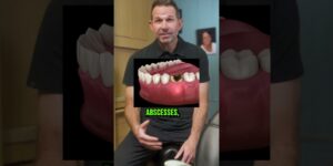 CAVITIES! What Happens When You Don't Get a Filling?!