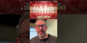 Can Dental Implants Save Your Smile? Cosmetic Dentists Dental Implant Review