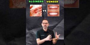 Clear Aligners Vs Veneers? Which is Better For You?