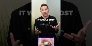 Considering #Invisalign for your future? Here’s the cost breakdown