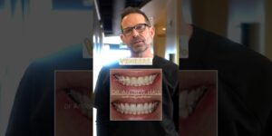 Do You Want Dental Veneers?