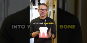 How Expensive Are Dental Implants?
