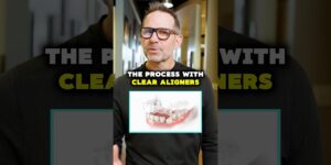 Removing Wisdom Teeth for Clear Aligners? | Cosmetic Dentist Explains