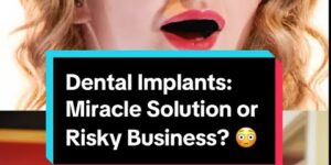 Dental Implants: Miracle Solution or Risky Business? Cosmetic Dentist Explains
