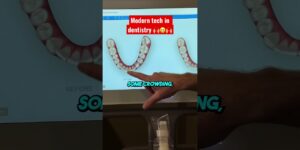 Dental technology for teeth before and after