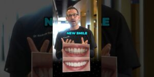 If you’re wanting to change the size & shape of your teeth this will be the process