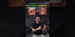 Veneers or Clear Aligners? Which is BETTER?
